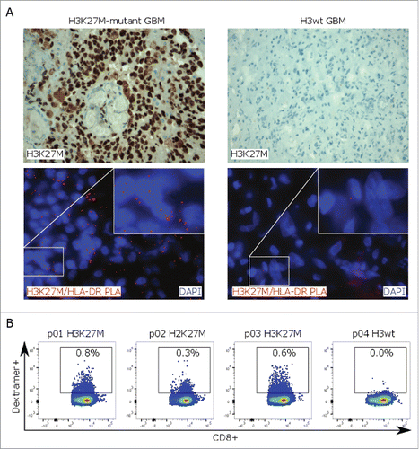 Figure 4. H3K27M-specific T-cell responses in glioma patients. (A)H3K27M staining (upper row) and in situ proximity ligation assay (PLA, lower row) with H3K27M and HLA-DR antibodies (red signal) on H3K27M-mutant or H3 wild type glioma tissue. Cell nuclei are visualized with DAPI (blue). (B) Detection of mutation-specific CD8+ T cells in PBMC samples of glioma patients using a H3K27M p26–35-specific HLA-A*0201 dextramer. PBMCs were analyzed after ex vivo expansion in presence of H3K27M p26–35 and hIL-2 for 9 d. Individual dot plots are shown.