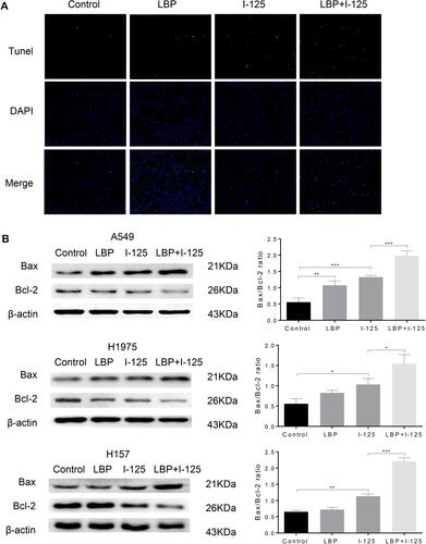 Figure 2 LBP enhanced 125I-induced apoptosis in NSCLC cells. (A and B) After NSCLC cells were treated with 125I, LBP (10% of IC50), or their combination, TUNEL assay in A549 cells was performed and Bax/Bcl-2 expression level in A549, H1975, and H157 cells was detected to analyze cellular apoptosis. The data are presented as the mean ± SD. One-way ANOVA was used for data analysis; *P < 0.05, **P < 0.01, ***P < 0.001.