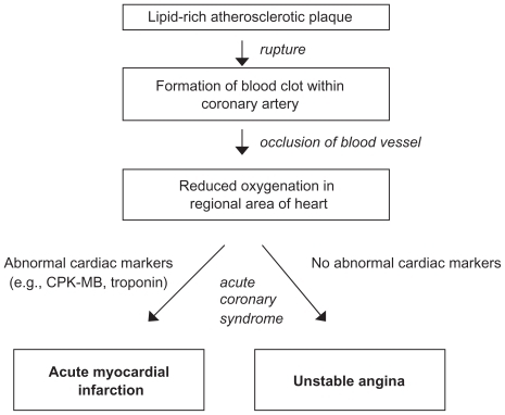 Figure 1 Pathophysiology of acute coronary syndrome.