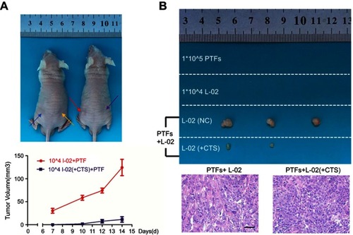 Figure 6 PTFs induced hepatocarcinogenesis through IL-6/p-STAT3 signaling in vivo.Notes: (A) Non-tumor L-02 cells and PTFs were subcutaneously injected into BALB/c nude mice alone or together. Blue arrow means injecting PTFs; yellow arrow means 104 L-02 cells; red arrow means 104 L-02 cells injected with PTFs; purple arrow means 104 CTS treated L-02 cells injected with PTFs. (B) Tumors formed two weeks after inoculation in each group are shown. Tumor formation was confirmed malignant by H&E staining. Scale bar, 200 µm. n=3.Abbreviations: CTS, cryptotanshinone; PTFs, peri-tumor fibroblasts.
