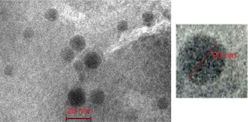 Figure 4 Transmission electron microscope photograph of soy phytosome-optimized formulation.