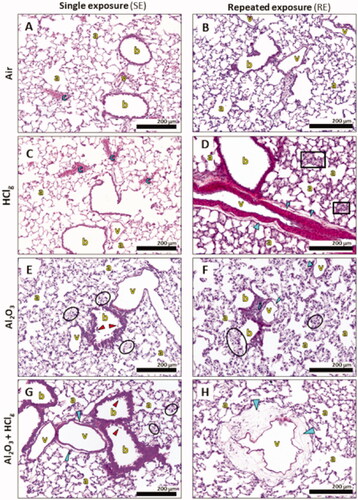 Figure 6. Pulmonary histopathological lesions observations following inhalation exposures. Rats lung parenchyma stained in HPS were observed in optical microscopy for histopathological analysis. Images show, respectively, lung parenchyma 24 h after single exposure (SE) to air (A), HClg (C), Al2O3 (E) and Al2O3 + HClg (G) and 24 h after repeated exposures (RE) to air (B), HClg (D), Al2O3 (F) and Al2O3 + HClg (H). Scale bar = 200 μm. Pictures legends: a = alveoli; b = bronchioles or bronchi; v = blood vessel; c = vascular congestion; blue arrows = vascular edema; red arrows = bronchial (pre)-exfoliation; i = inflammatory area; black squares = velamentous epithelium and black circles = interalveolar septum edema.