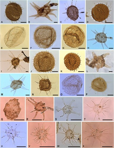 Figure 5. Organic-walled phytoplankton of the Borenshult-1 drillcore. Taxon, sample number, and England Finder Reference (EFR). Scale bars 20 μm. A. Baltisphaeridium flagellicum, (71.1 m) EFR: Q19/1a; B. Baltisphaeridium (cf. Pachysphaeridium) goeranii, (67.6 m) EFR: J23/1a; C. Baltisphaeridium cf. B. granosum, (34.45 m) EFR: Q46/2; D. Baltisphaeridium hirsutoides, (67.6 m) EFR: D11/0a; E. Baltisphaeridium microspinosum, (38.06 m) EFR: O25/3; F. Baltisphaeridium multipilosum, (41.1 m) EFR: U21/0a; G. Baltisphaeridium nanninum, (36.3 m) EFR: W14/1; H. Baltisphaeridium perclarum, (36.4 m) EFR: P10/3a; I. Baltisphaeridium cf. C. pseudocalicispinum, (71.1 m) EFR: Q16/0a; J. Baltisphaeridium ritvae, (59.1 m) EFR: K11/4a; K. Baltisphaeridium cf. B. trichophorum, (36.4 m) EFR: U38/2a; L. Baltisphaeridium trophirhapium, (48.2 m) EFR: S48/3b; M. Baltisphaeridium trophirhapium aff. B. trophirhapium in Uutela & Tynni (Citation1991), (36.3 m) EFR: H10/2; N. Baltisphaeridium cf. B. varsoviensis, (40.1 m) EFR: L26/3; O. cf.?Baltisphaeridium sp. in Delabroye et al. (Citation2011b), (40.2 m) EFR: W28/1; P. Baltisphaeridum? sp. A, (71.1 m) EFR: M22/3a; Q. Buedingiisphaeridium? sp. A, (40.35 m) EFR: N29/3; R. Cheleutochroa clandestina, (34.45 m) EFR: R45/0; S. Cheleutochroa cf. C. clandestina, (41.1 m) EFR: N11/4a; T. Cheleutochroa diaphorosa, (33.05 m) EFR: F27/0b; U. Cheleutochroa diaphorosa, (33.05 m) EFR: V38/4b; V. Cheleutochroa cf. C. elegans, (33.05 m) EFR: H47/3b; W. Cheuletochroa homoia, (38.7 m) EFR: Q17/2; X. Cheleutochroa cf. C. meionia, (33.05 m) EFR: N24/4a.