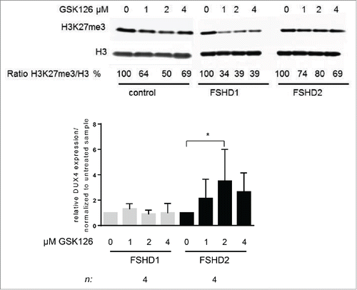 Figure 4. Treatment of FSHD2 myotube cultures with EZH2 inhibitor GSK126 increases DUX4 levels. (A) Western blot analysis of control, FSHD1, and FSHD2 myotube samples after treatment with 0, 1, 2, and 4 μM GSK126. Blots were probed with H3K27me3 antibody and H3 antibody as loading control. Shown are the reduced ratios of H3K27me3:H3 signal intensities in samples treated with GSK126 compared to the untreated sample as a result of EZH2 inhibition. (B) qRT-PCR analysis of DUX4 expression in FSHD1 and FSHD2 myotubes after GSK126 treatment shows that relative DUX4 transcript levels are significantly increased in FSHD2 samples treated with 2 μM GSK126 but not in FSHD1 myotubes. Graph shows the results of 4 FSHD1 and 4 FSHD2 cell lines. Results of control cell lines are not shown, DUX4 transcript was not detectable. Error bars show SD, n indicates number of independent cell lines, and significance was tested by 2-way ANOVA followed by Bonferroni multiple comparison test. *=P <0.05.