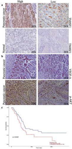 Figure 2. TM4SF1 expression and association with poor overall survival of pancreatic cancer patients. (a) Immunohistochemistry. Representative images of TM4SF1 expression in pancreatic cancer vs. normal tissue samples. (b) Immunohistochemistry. Representative images of VEGF-A and p-AKT expression in patients with high and low TM4SF1 expressing pancreatic cancer. (c) The Kaplan-Meier curves and the log rank analysis of 177 pancreatic cancer patients stratified by high and low expression of TM4SF1 in the TCGA profile dataset.