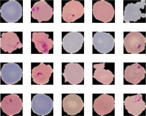 Figure 1. Images of infected and uninfected blood samples.