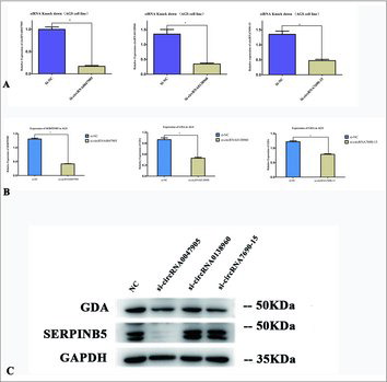 Figure 5. Relative expression of circRNAs and mRNAs in AGS human GC cell lines transfected with specific siRNA targeted circRNAs. (A) Relative expression of circRNAs in AGS GC cell lines transfected with specific siRNA. *P < 0.05. (B) Relative expression of parental gene mRNAs in AGS GC cell lines transfected with specific siRNAs respectively targeted circRNAs. *P < 0.05. (C) Expression of SERPINB5 and GDA protein in AGS GC cell line transfected with specific siRNAs.