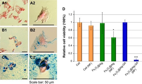 Figure 5 (A–C) Cell morphology of HepG2 cells (A1, A2) treated with Fe3O4@Alg nanoparticles (B1, B2) and Fe3O4@Alg-GA nanoparticles (C1, C2). (D) Viability of HepG2 cancer cells incubated with Fe3O4@Alg and Fe3O4@Alg-GA nanoparticles with and without a magnetic field. The * and *** indicate the apparent difference of the results.Abbreviations: Alg, alginate; DI, deionized; Fe3O4, iron oxide; GA, galactosamine; MF, magnetic field.