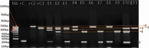 Figure 1. Multiplex PCR amplification of the ESBLs encoding genes. 1000 bp ladder (1Kb)-Eurofins genomics, Positive control 1 (+C1)-E. coli ATCC 35218, Positive control 2 (+C2)-K. pneumoniae 7881, Positive control 3 (+C3) K. pneumoniae ATCC 700603; Amplicon level 1 represents CTXM-15 gene (approx. 995bp), level 2: TEM gene (approx. 856bp), level 3:SHV-2 gene (approx. 713bp), level 4:CTXM-U gene (approx. 596bp, level 5:SHV-1 (approx. 230bp) and E1–E10 representative E. coli isolates