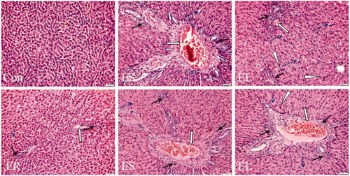 Figure 6. Representative microscopic photographs of the rat liver slices stained with H&E (200×). The rats were treated with the ethanol extracts of different parts of C. serratus (ER: 4.14 g/kg/day, ES: 3.20 g/kg/day and EL: 1.16 g/kg/day) for 14 days. The Con group: normal histological architecture and cell structure; the ER group: slight vasodilatation and congestion (Display full size), inflammatory cell infiltration (Display full size); the ES group: vasodilatation and congestion, inflammatory cell infiltration, steatosis (Display full size) and edema fluid; the EL group: vasodilatation and congestion, edema fluid, focal necrosis, eosinophilic degeneration (Display full size) and steatosis.