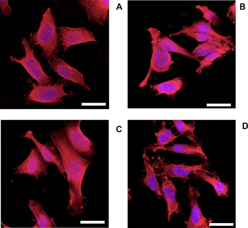 Figure 7 Actin staining epifluorescent images of human osteoblast (Saos-2) (A) no DEX; (B) LPS; (C) LPS+ DEX-P and (D) DEX from release buffer after 24-hr exposure assessed by confocal microscopy. Actin rings and nuclei of cells were stained with phalloidin-FITC and DAPI, respectively. Bar corresponds to 20 µm.Abbreviations: LPS, lipopolysaccharides; DEX, dexamethasone; DEX-P, dexamethasone phosphate.