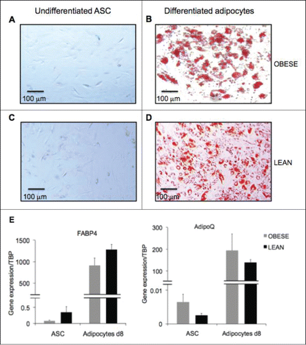 Figure 3. Generation of differentiated adipocytes from ASC derived from subcutaneous AT of obese donors. Chehimi et al., p. 277.