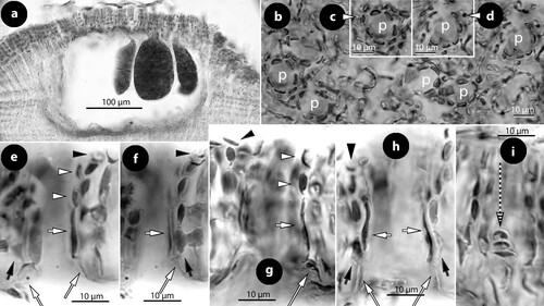 Figure 4. Thallis capensis gen. & sp. nov. Tetrasporangial conceptacle structures (isotype); a, tetrasporangial conceptacle with three tetrasporangia; b–d, views of a multiporate roof from above showing pore (p) canals surrounded by 6–7 pore cells; e–h, sections of canals of multiporate roofs showing filaments lining the canals. Note the branched basal cells (long white arrows), each supporting a normal roof filament (black arrows) and the rest of the lining filament that is composed of an elongate subbasal cell (short white arrows) followed by two cells (arrowheads). Pore filaments lack epithallial cells and terminate below the roof surface, i.e. epithallial cells (black arrowheads) of adjacent roof filaments; i, a diminutive, 3-celled, filament (broken arrow) at the canal base. Abbreviations: p (pore canal).