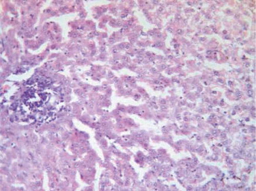 FIGURE B5. Supplementation rats with both trapidil and l-arginine showed mild interstitial lymphocyte aggregation in the hepatic parenchyma (H&E, ×120).