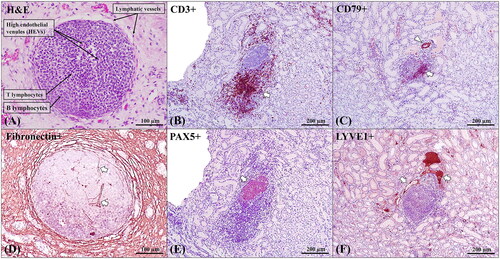 Figure 3. Histopathological and immunohistochemical characterisation of the TLOs in ASF infected tissues of wild boar under experimental conditions. (A) Evaluation of histological structure and cell composition. The TLOs were composed of B and T lymphocytes, with high endothelial venules (HEVs) on the inside, and lymphatic vessels surrounding the formation. HE stain, 200x. (B) T-cells (arrow) have marked CD3+ immunoexpression. Rabbit polyclonal anti-CD3, 100x. (C) B-cells (arrow) and blood vessels (arrowhead) have marked CD79+ immunoexpression. Mouse monoclonal rabbit anti-CD79, 100x. (D) Marked reticular extracellular matrix fibronectin+ immunoexpression inside the TLO (arrow), compatible with formation of microchannels (conduits). Rabbit polyclonal anti-fibronectin; 100x. (E) B-cells (arrow) have marked PAX5+ immunoexpression. Mouse monoclonal rabbit anti-PAX5; 100x. (F) Lymphatic vessels (arrow) have marked LYVE1+ immunoexpression. Rabbit polyclonal anti-LYVE1, 100x.