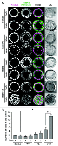 Figure 2. Morphological change upon Rac1 expression. (A) MDCK-TIR (denoted as control) and various MDCK-Rac1 cells expressing H1-Keima (denoted as Nucleus) and GFP-CAAX (denoted as Plasma membrane) were cultured to form cysts in the presence of 50 μM NAA for 10 d. Cysts were washed and further cultured for 5 d with (+) and without (−) NAA and imaged by a confocal microscope. Shown are the representative images from at least two independent experiments. The scale bar is 20 μm. (B) Fluorescent images obtained in Figure 2A were quantified. The numbers of cells in the luminal space were counted from H1-Keima images. Averages with the standard deviation (sd) are shown. *p < 0.05 by Student’s t-test. The numbers of scored cysts were as follows: control (+) 152, control (−) 155; Rac1 WT (+) 663, Rac1WT (−) 554; Rac1b(+) 461, Rac1b (−) 538; Rac1V12 (+) 164, Rac1V12 (−) 172.