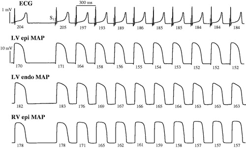 Figure 1. Representative ECG and monophasic action potential recordings obtained upon an abrupt acceleration of cardiac beating rate. ECG, left ventricular (LV) epicardial (epi), LV endocardial (endo), and right ventricular (RV) epicardial monophasic action potentials (MAP) were recorded during spontaneous beating (the first beat in all panels), and upon initiation of rapid cardiac pacing. Spontaneous running cardiac cycle length was 610 ms, and the cycle length during pacing was 300 ms. Vertical dotted lines on ECG show the moments of regular stimulus (S1) application. The numbers (ms) below traces show beat-to-beat changes in QT interval and APD90 at epicardial and endocardial recording sites. Note the adaptation of ventricular repolarization to increased cardiac activation rate, as indicated by about 20 ms shortening in QT interval and APD90 over first seven paced beats, compared to the values determined prior to S1-S1 stimulation.
