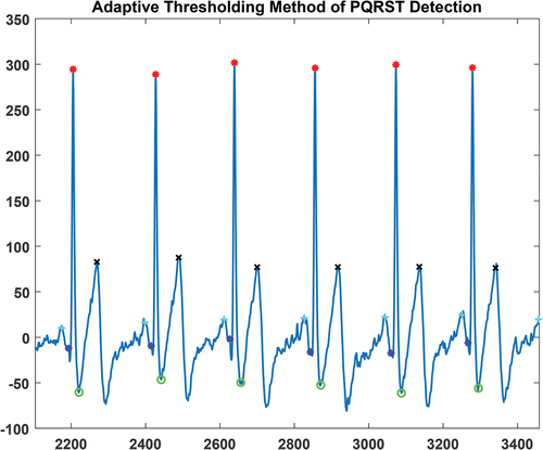 Figure 5. PQRST Peak Detection using Adaptive Thresholding.