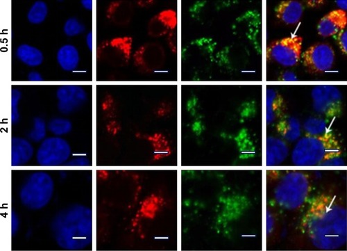 Figure 10 Intracellular trafficking of DHP16 in A549 cells at different time intervals by LSCM.Notes: Blue fluorescence from nucleus stained with Hoechst 33,258, red fluorescence from the lyso-tracker stained lysosomes, and green fluorescence from FITC labeled DHP16. The right panel shows the merged image of the three channels. Scale bars =20 µm. White arrows emphasize the distinct region of fluorescence fusion.Abbreviations: DHP, pDNA/HMGB1/PAMAM-SS-PEG-RGD; FITC, fluorescein; LSCM, laser scan confocal microscope; PAMAM, polyamidoamine; PEG, polyethylene glycol; RGD, arginine-glycine-aspartate.