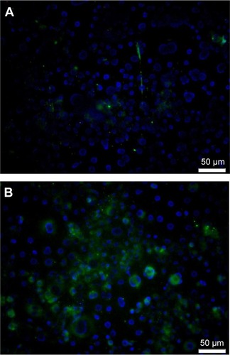 Figure 10 Fluorescent microscope image after cell differentiation experiments on a (A) control and (B) peen-treated Ti sample.Abbreviation: Ti, titanium.