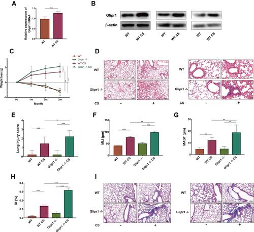 Figure 1 Glipr1 knockout exacerbated CS-induced airway damage. (A) mRNA and (B) protein levels of Glipr1 in lung tissues of mice were increased after CS exposure. (C) Weight of mice (in grams) after CS exposure. (D) Hematoxylin and eosin (HE) staining. (E–H) Quantitative analysis of lung damage as assessed histopathologically. (E) Lung injury scores. (F) Mean linear intercept (MLI). (G) Mean alveolar septal thickness (MAST). (H) Destructive index (DI). Ten fields were randomly selected for scoring. (I) Masson’s staining. Error bars represent SD. *P < 0.05; **P < 0.01; ***P < 0.001.