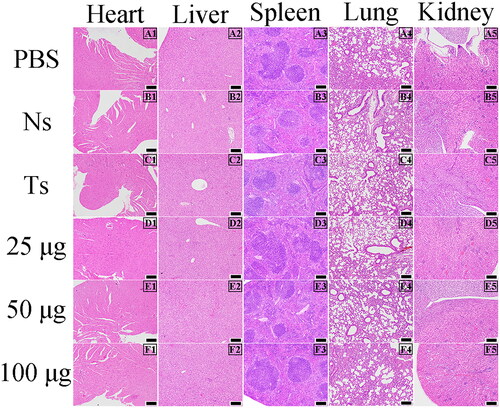 Figure 3. Pathological observations in nude mice (100 ×). Pathological observation of heart, liver, spleen, lung, and kidney in tumour-bearing nude mice treated with PBS, negative serum (Ns), anti-T. spiralis serum (Ts), and different doses of anti-Ts7TMR scFv (25, 50, and 100 μg). Scale bar = 100 μm.