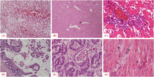 Figure 3. Microscopic examination of histopathologic changes in different tissues collected from pigeons infected with velogenic strain. Arrows indicate histologic and pathologic lesions in (A) lung, (B) brain, (C) liver, (D) small intestine, (E) gizzard and (F) heart.