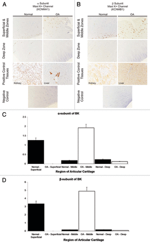 Figure 2. Immunohistochemical identification of KCNMA1 (BK α-subunit) and KCNB1 (BK β-subunit) in sections of healthy and OA equine cartilage. The data from normal equines is reproduced with permission from Mobasheri et al.Citation45 Macroscopically normal articular cartilage samples were obtained from weight-bearing regions of the metacarpophalangeal joints of horses of mixed breed, age, and sex. Joint tissues were sourced from an abattoir in Nantwich, Cheshire and Taunton Devon. Animals were euthanized for non-research purposes having been stunned before slaughter for meat in accordance with Welfare of Animals (Slaughter or Killing) Regulations 1995. Sections of normal (n=6) and OA (n=3) equine cartilage were probed for channel expression by immunohistochemistry essentially as previously described.Citation45 Sections were incubated overnight at 4°C with rabbit polyclonal antibodies to the KCNMA1 and KCNB1. Antibody dilutions used ranged from 1:200 to 1:1500 in tris-buffered saline containing 1% bovine serum albumin. Slides were incubated with horseradish peroxidase-labelled polymer conjugated to affinity-purified goat anti-rabbit immunoglobulins. Cell nuclei were counterstained by incubation with aqueous haematoxylin (code no. S3309; Dako). Positive control samples were included from liver and kidney. Omission of primary antibody served as negative controls. Photomicrographs of immunostained tissue sections captured using Nikon Digital Sight DS-5M camera driven by Nikon Eclipsenet image capture software (Nikon). Positive staining is indicated by brown staining and particular evident at middle/superficial zones. (C and D) Semi-quantified protein expression density. The largest increase in expression density (from data such as that illustrated in Fig. 2) is in the middle zone, for both KCNMA1 (C) and KCNMB1 (D) (α- and β- subunit respectively). Note that in OA tissue there was insufficient superficial data to quantify expression levels.