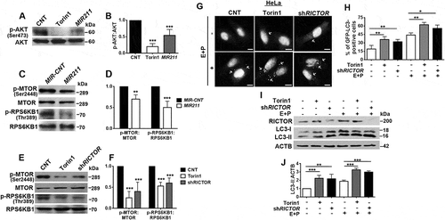 Figure 6. MIR211 regulated the MTORC1 pathway through RICTOR. (a) MTORC2-mediated AKT Ser473 phosphorylation was decreased in HeLa cells overexpressing MIR211. Torin1 was used as a positive control. (b) Graph depicting quantification of p-AKT:AKT ratios in the experimental set-up shown in A (mean± SD, n = 3 independent experiments, ***p < 0.01). (c) MTOR phospho-Ser2448 (p-MTOR) and RPS6KB1 phospho-Thr389 levels were decreased following MIR211 overexpression in HeLa cells. (d) Graph depicting quantification of p-MTOR:MTOR and p-RPS6KB1:RPS6KB1 ratios in the experimental set-up shown in C (mean± SD, n = 3 independent experiments, ***p < 0.01, **< 0.03). (e) Knockdown of RICTOR by shRNA (shRICTOR) decreased p-MTOR and p-RPS6KB1 levels. Torin1, positive control. (f) Graph depicting quantification of p-MTOR:MTOR and p-RPS6KB1:RPS6KB1 ratios in the experimental set-up shown in E (mean± SD, n = 3 independent experiments, ***p < 0.01). (g) Knockdown of RICTOR increased GFP-LC3 dot formation. Torin1, positive control. E + P, E64D and pepstatin A. Scale bar: 10 µm. (h) Quantitative analysis of GFP-LC3 dots in the experimental set-up shown in G (mean± SD of n = 3 independent experiments, **p < 0.03, *p < 0.05). (i) Immunoblots of LC3-II formation following knockdown of RICTOR. Torin1, positive control. (j) Graph depicting quantification of LC3B:ACTB ratios in the experimental set-up shown in I (mean± SD, n = 3 independent experiments, ***p < 0.01, **p < 0.03).