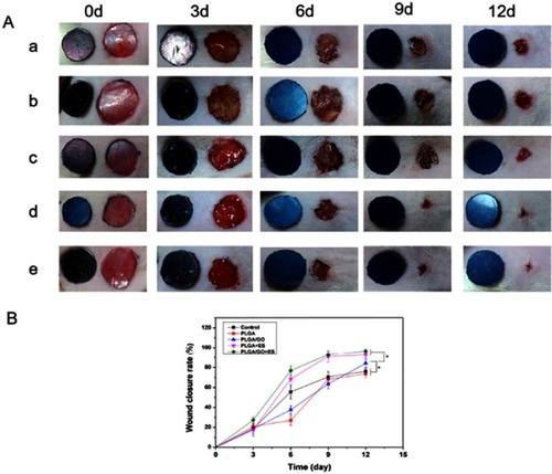 Figure 4 The differential effects of PLGA/GO composites and ES on wound healing. (A) Representative macroscopic appearance of wounds. (a) Control, (b) PLGA, (c) PLGA/GO composites (2 wt%), (d) PLGA + ES, and (e) PLGA/GO composites (2 wt%) + ES. (B) Wound-healing curves. *P<0.05 (n=5).