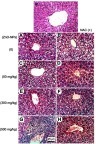 Figure 5 Representative photomicrographs of liver tissues of mice treated with different doses of ZnO-NPs (50, 300 and 500 mg/kg) with and without pretreatment with NAC (100 mg/kg). (NL) normal liver group showing no histopathological change (A) ESC group showing hydropic degeneration of hepatocytes, (B) ESC+NAC group showing hydropic degeneration of hepatocytes, (C) ESC+50 ZnO-NPs group showing hydropic degeneration of hepatocytes, (D) ESC+50 ZnO-NPs+NAC group showing Kupffer cells activation, (E) ESC+300 ZnO-NPs group showing vacuolar degeneration of hepatocytes, (F) ESC+300 ZnO-NPs+NAC group showing vacuolar degeneration of hepatocytes, (G) ESC+500 ZnO-NPs group showing massive mononuclear inflammatory cells infiltration in the portal triad, (H) ESC+500 ZnO-NPs+NAC group showing vacuolar degeneration of hepatocytes and congestion of hepatoportal blood vessel (H and E × 400).