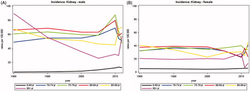 Figure 1. Incidence rates of kidney cancer in Denmark, 1980–2012, by age group. A. Males, B. Females.