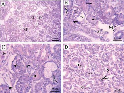 Figure 11. Photomicrographs of fetal kidney transverse sections (stained with H&E) at 20th day of gestation. (A) Control group: distinct Bowman’s capsule-enclosed normal glomeruli with normal urinary space. Renal tubules with normal nuclei were observed. (B) LD group, (C,D) HD group: damaged glomeruli surrounded by a decomposed Bowman’s capsule basement membrane (head arrow)and increase in the intercapsular space (line), disappearance of lumen of renal tubules (arrow), damaged tubules (wavy arrow), necrosis, Karyolysis, increase in the number of parenchymal cells and renal tubule hypertrophy (curved arrow). BC = Bowman’s capsule, G = glomeruli, RT = renal tubules, N = necrosis, K = karyolysis, and Pa = parenchymal cells