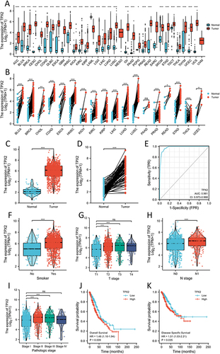 Figure 1 TPX2 expression level in NSCLC and its relationship with clinicopathological features. (A) Expression of TPX2 in different tumor types compared to nonmatching normal tissues in TCGA and GTEx databases. (B) TPX2 expression in different tumor types compared to matched normal tissues in TCGA and GTEx databases. (C) TPX2 expression in NSCLC and nonmatching normal tissues in TCGA databases. (D) TPX2 expression in NSCLC in TCGA database with matching normal tissues. (E) ROC curves for classifying NSCLC versus normal breast tissues in the TCGA database. (F–K) Data are shown for (F) smoker; (G) T stage; (H) N stage; (I) Pathologic stage; (J) Overall Survival; and (K) Disease Specific Survival. *p<0.05, **p<0.01 and ***p<0.001.