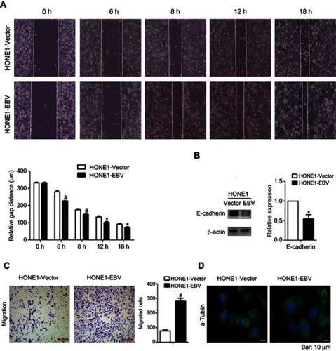 Figure 3 EBV genome introduction on NPC promoted the migration of HONE1 cells. (A) Wound healing assays were performed in HONE1-Vector and HONE1-EBV cells. Migration activity was determined by measuring the distance from boundary lines of scratch to cell-free space at different time points (0, 6, 8, 12 and 18 h). (B) The expression level of E-cadherin protein was measured by western-blot in HONE1-Vector and HONE1-EBV cells. (C) Transwell assay was performed to detect the migration ability of HONE1-Vector and HONE1-EBV cells. (D) Immunoﬂuorescence of α-Tubulin in HONE1-Vector and HONE1-EBV cells (bar:10 μm). Experiments were repeated at 3 times, and error bars represent ± SD. (*P<0.05, #P<0.001 versus vector group).