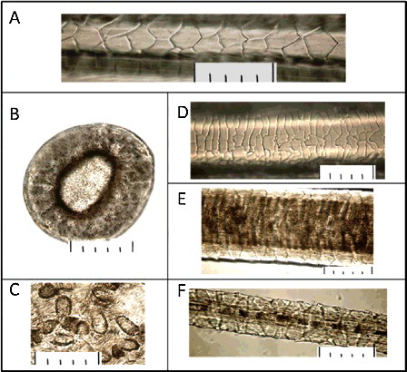 Figure 4. Microstructure of leopard hair collected at the crime scene: (A) cuticle in the base of a pile hair; (B) cross section of a pile hair in a grana; (C) the medulla disks received in the course of alkaline thermohydrolysis; (D) cuticle in an expanded part of a pile hair; (E) medulla in an expanded part of a pile hair; (F) microstructure of a fur hair. The scale at all photos: one small division on a large-scale ruler is equal to 10 μ (microns), respectively 5 divisions = 50 μ (microns).