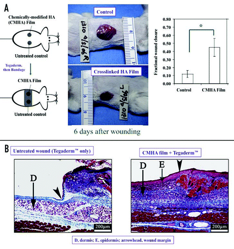 Figure 5 (A) Wound repair model and evaluation of a one-component sECM composed of only a crosslinked HA derivative. (B) Improved histological outcomes include wound filling, production of a vascularized dermis, and regeneration of a new epithelium complete with stratum corneum.