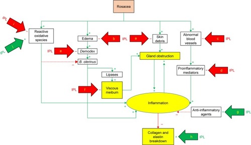Figure 2 Mechanisms of action of IPL (simplified model).