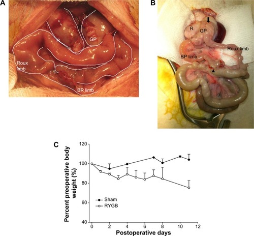 Figure 2 RYGB in the rat model.Notes: (A) Intraoperative imaging of RYGB rat. (B) View of gastrointestinal tract exposed outside the abdominal cavity. The arrow indicates the connection of the gastric pouch to the Roux limb. The triangle indicates the connection of the biliopancreatic limb and the Roux limb. (C) Change in body weight of sham rats and RYGB rats after surgery.Abbreviations: R, remaining stomach; GP, gastric pouch; BP limb, biliopancreatic limb; RYGB, Roux-en-Y gastric bypass.