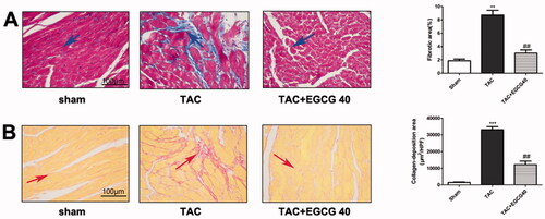 Figure 4. EGCG reduces fibrotic and condensed collagen-deposition areas in mice with TAC. (A) Masson’s trichrome staining of different groups. (B) Sirius red staining of different groups. ***p < 0.001 as compared with the sham group. ##p < 0.01 as compared with the TAC group.