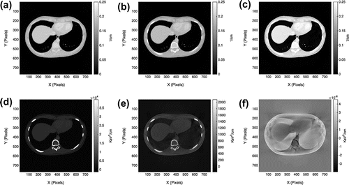 Figure 5. Compton and photoelectric images: the first row is the reconstruction results for the Compton scatter case and the second row is the reconstruction results for the photoelectric case. (a) and (d) are reconstructed by the proposed iterative method. (b) and (e) are the first-order method. (c) and (f) are the second-order methods.