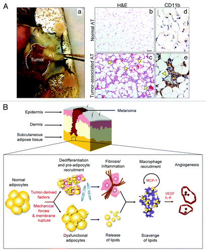 Figure 1. Characteristics of tumor-associated adipose tissue. Representative photograph of adipose tissue (AT) juxtaposed to subcutaneously-implanted B16F10 mouse melanoma (Aa). Hematoxylin-eosin histological examination of normal AT (Ab) and tumor-associated AT (Ac) revealed reduced adipocyte size in tumor-associated AT together with numerous, dilated blood vessels and extensive fibrosis. Yellow arrowheads identify blood vessels. Size bar, 50 µm (Ab–c). Immunohistochemical analysis revealed massive infiltration of CD11b+ cells surrounding blood vessels in tumor-associated AT. Yellow arrowhead identifies a blood vessel. Size bar, 25 µm (Ad–e). Proposed model of interactions between adipocytes, macrophages and vascular endothelial cells within tumor-associated AT using vertical growth-phase melanoma as a model (B). The mass of tumor cells may cause rupture of fragile adipocyte membrane leading to cell death and release of lipids. Free lipids are scavenged by macrophages. Furthermore, in the presence of tumor-derived factors, adipocytes may dedifferentiate into fibroblast-like cells and preadipocytes are mobilized to replace dead or dying adipocytes. The lipid-laden, “activated” macrophages instigate an inflammatory response, which further contributes to fibrosis and extracellular matrix (ECM) deposition. New ECM creates scaffolding for blood vessels and factors such as MCP-1, VEGF and IL-6, secreted by activated macrophages, stimulate angiogenesis and further macrophage recruitment.