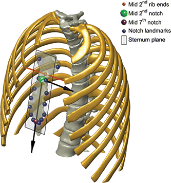 Figure 2. Sternum plane placement and orientation. The plane origin (largest sphere marker) is parameterized by its offset (STNM[y|z]Offset) from the midpoint between second rib distal ends (smallest sphere marker). The sternum plane pitch (STNMpitch) is measured against the vertical axis in the sagittal view.