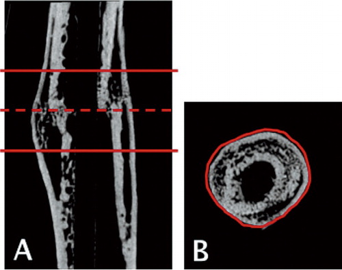 Figure 1. The region of interest (ROI) for each bone was determined by first identifying the fracture line (dashed line) and then defining a region approximately 3 mm (150 images) proximal and distal to the fracture line (solid lines) (panel A). Within the defined ROI, semi-automatic segmentation was used on each 2D image to identify the circumferential boundaries of the calluses (panel B).