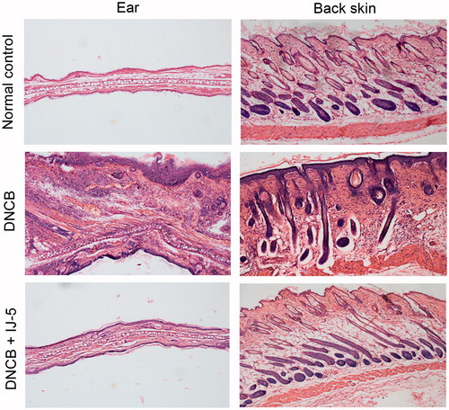 Figure 3. The effect of IJ-5 on histological changes in the ears and back skins of DNCB-challenged mice. The right ear tissues and the back skin were harvested at 48 h after fifth DNCB challenge. The skin sections were prepared and stained with hematoxylin–eosin.
