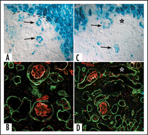 Figure 8 Sections showing hybrid glomeruli. Top panels are from separate samples processed for LacZ, lower panels show corresponding serial sections immunolabeled for laminin. (A and C) Host tissue is intensely blue and can easily be distinguished from graft (dashed black line demarcates margin between host and graft tissue). Note ingress of a number of host-derived cells into graft, and the formation of hybrid glomeruli (arrows) containing host (blue) endothelial cells. (B and D) Immunofluorescence images of serial sections doubly labeled for laminin α1 (green) and α5 (red) chains. Laminin α5 protein is present in GBMs of hybrid glomeruli. (* marks same tubule in serial sections). Reproduced with permission (ref. Citation100).