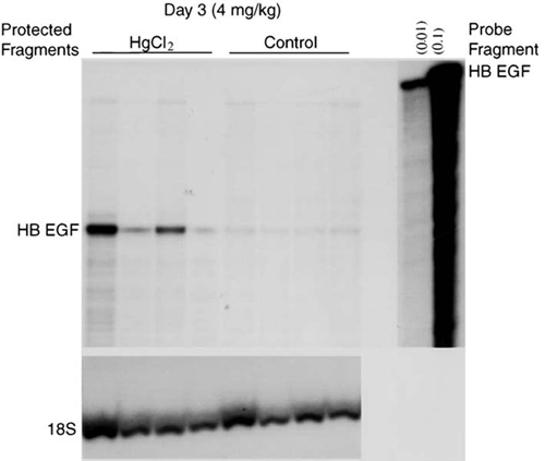 Figure 2. Gel of the probe and protected fragments after solution hybridization for heparin binding EGF at day 3 in controls and mercuric chloride treated rats. 18S is presented in the lower panel.