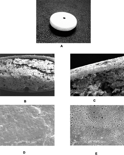 Figure 2 Physical evaluation and electron scan micrograph of (A) an image of metoclopramide osmotic tablet showing an orifice. (B) cross-section of the optimized formulation membrane showing uniform formation od semipermeable membrane (C) coating thickness of the tablet membrane structure of optimized formulation before dissolution (D) membrane structure of optimized formulation before dissolution (E) membrane structure of optimized formulation after dissolution.