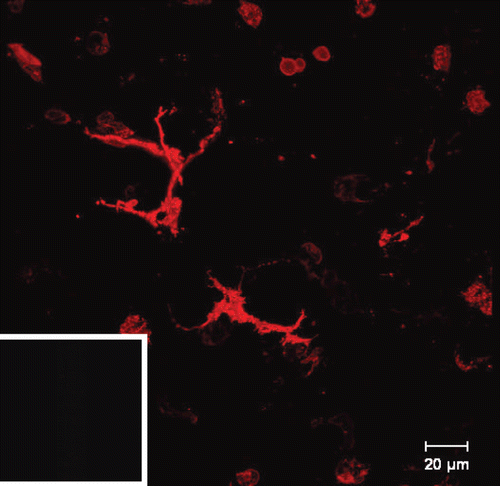 Figure 5.  Ex vivo staining of MHC class II in live murine precision-cut lung slices after 24 h. The images were taken by confocal microscopy. A limited number of MHC class II+ cells were found in alveolar regions displaying DC morphology. Inset in the bottom left corner shows the respective isotype antibody control.