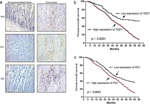 Figure 1. TIGIT and PD-1 expression in GC patients (a) Immunohistochemistry analysis of TIGIT, PD-1, and CD8 expression in gastric cancer (GC) tissues and adjacent normal tissues. (b) Kaplan Meier survival curve showed the association between TIGIT expression and over survival time in patients with GC (P < 0.0001). The patient number of high expression of TIGIT is 343 and the number of low expression is 98. (c) Kaplan Meier survival curve showed association between PD-1 expression and overall survival (OS) time in patients (P < 0.0001) The patient number of high expression of PD-1 is 310 and the number of low expression is 131.